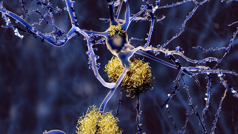 An Imminent Risk Factor for Alzheimer’s Disease?