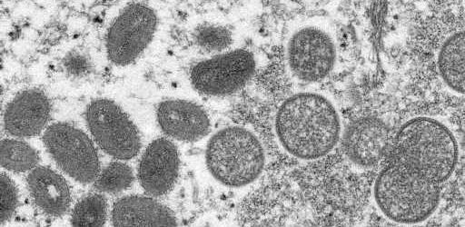 Here's Why Health Experts Aren't Worried About Monkeypox