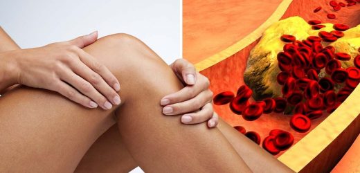 High cholesterol: Can you feel that? The ‘painful’ sign in your legs – expert
