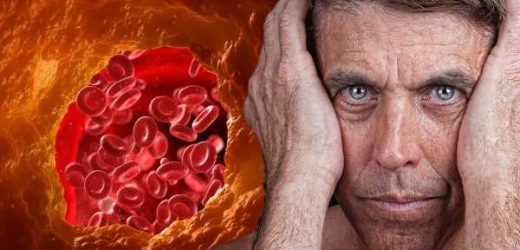 High cholesterol: Two visual clues on your face – ‘it’s a sign you have high cholesterol’