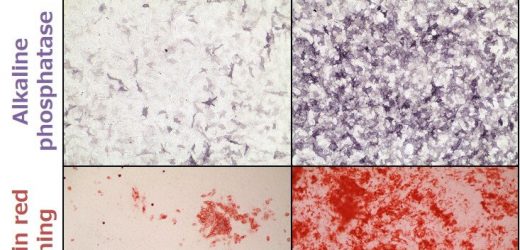 Identification of osteogenetic oligodeoxynucleotide that promotes bone differentiation