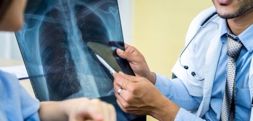 NHS will take five years to clear cancer backlog, charity warns
