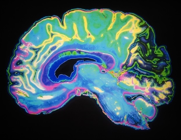 Neuroscientists pinpoint brain mechanism responsible for common type of age-related memory loss