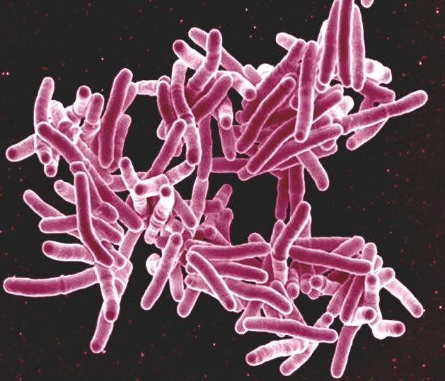 New study reveals hundreds of new drug targets to combat tuberculosis