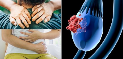 Ovarian cancer symptoms: Five ‘silent’ signs of ovarian cancer that are ‘often overlooked’