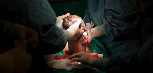 Study: No More Autopilot Opioids After Cesarean Delivery
