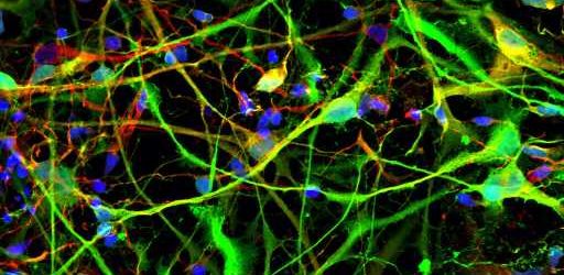 Study offers new insights on gene activity and addiction