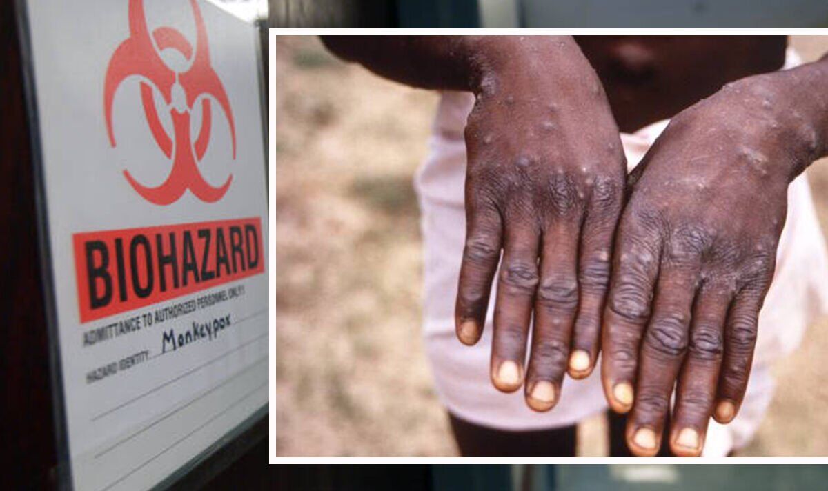 Why is Monkeypox called Monkeypox? Virus speads as UK cases more than double ‘Be alert’