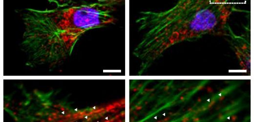 Working to stop the spread of breast cancer