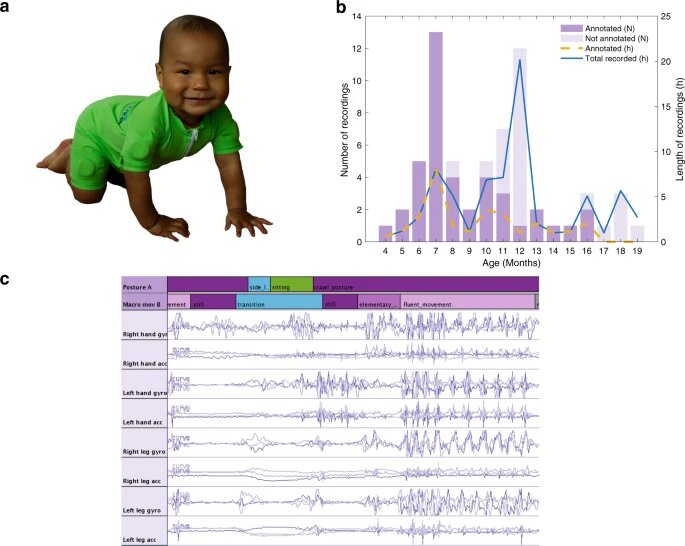 A smart jumpsuit tracks infants motor development