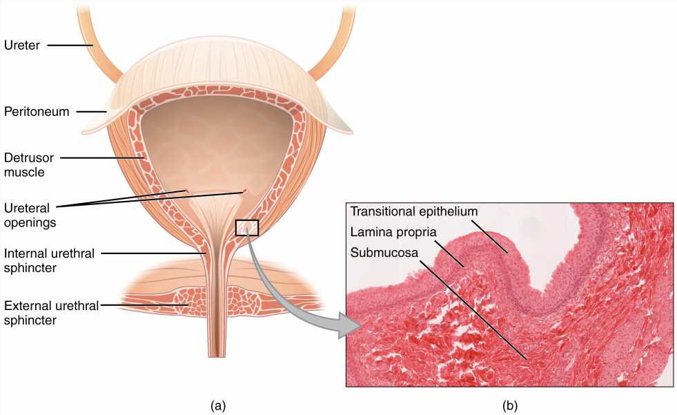 Consumer health: Treating bladder cancer