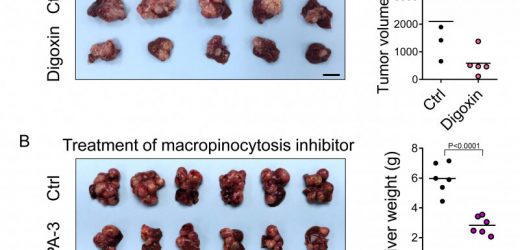 Discovering a new metabolic route for liver cancer and paving the way for new therapeutic opportunities