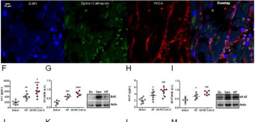 How the coronavirus attacks the heart