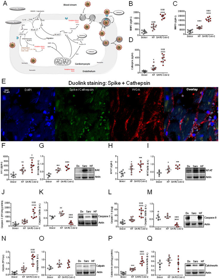 How the coronavirus attacks the heart