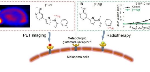 Novel radiopharmaceutical pair detects and treats melanoma, shows potential for broad application in solid tumors