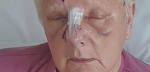 Pensioner in horror mauling by ‘pit bull-type’ dog had scalp torn apart