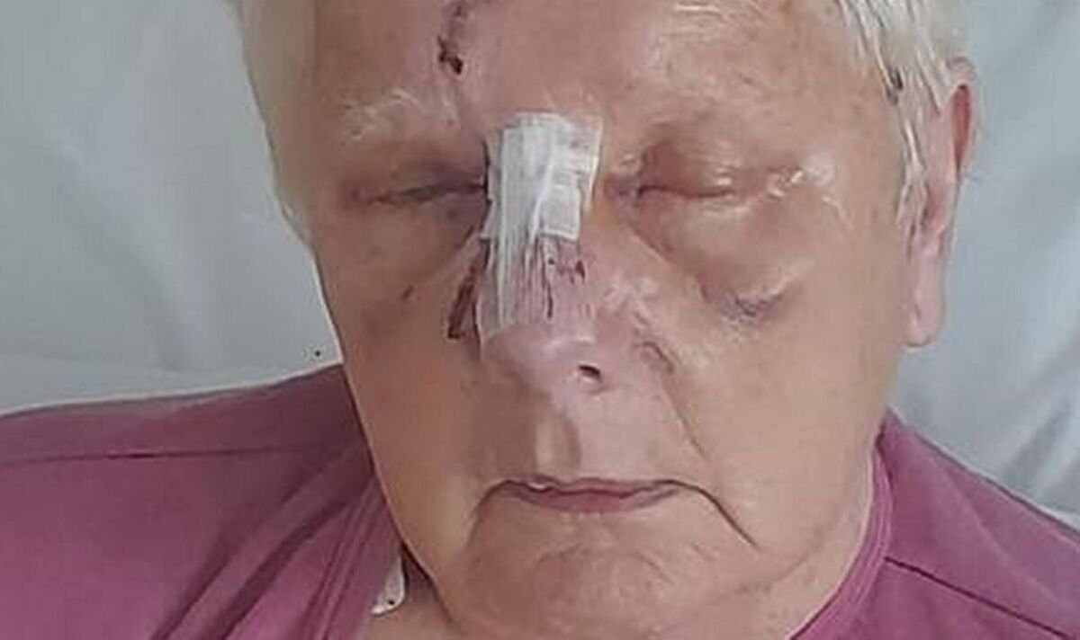 Pensioner in horror mauling by ‘pit bull-type’ dog had scalp torn apart