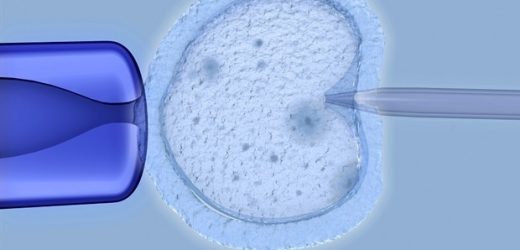 'Short GnRH antagonist protocol' likely to reduce the risk of ovarian hyperstimulation syndrome in IVF patients