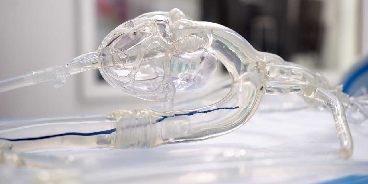 A magnetically steerable catheter for quick and safe stroke treatment