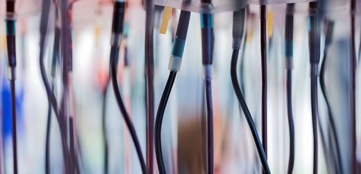 Alzheimer's: Targeting key protein in blood may slow progression