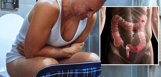 Bowel cancer symptoms: The feeling just before opening your bowels thats a major sign