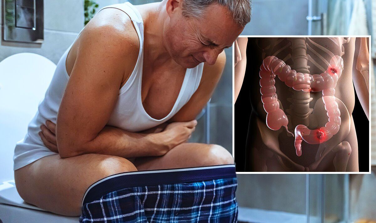 Bowel cancer symptoms: The feeling just before opening your bowels thats a major sign