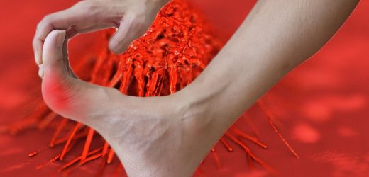 Cancer: The sign that often appears on the ‘thumb or big toe of the dominant hand or foot