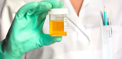 Colour of your wee shows how hydrated you are – and when you need to seek help