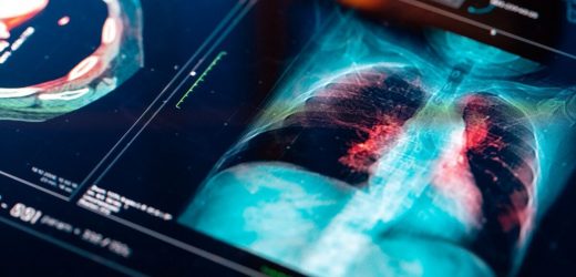 Coughing three weeks? Get lung cancer check, health chiefs say