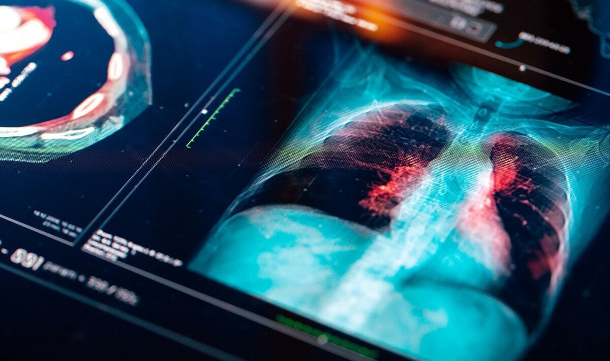 Coughing three weeks? Get lung cancer check, health chiefs say