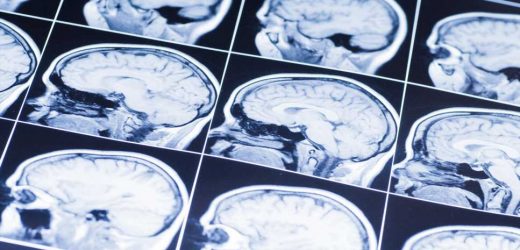 Head injuries in children linked to reduced brain size and learning difficulties