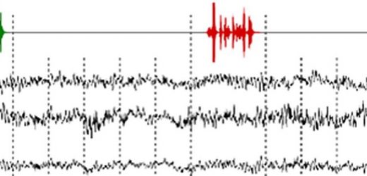 Hidden consciousness detected with EEG predicts recovery of unresponsive patients