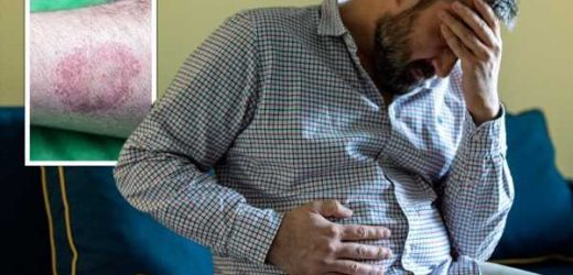 Lyme disease signs: ‘My digestion was terrible… I was in serious pain’ – Brit tells all