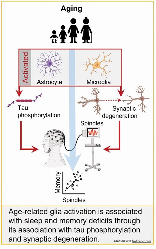 Research finds how brain inflammation may link Alzheimers risk, sleep disturbance