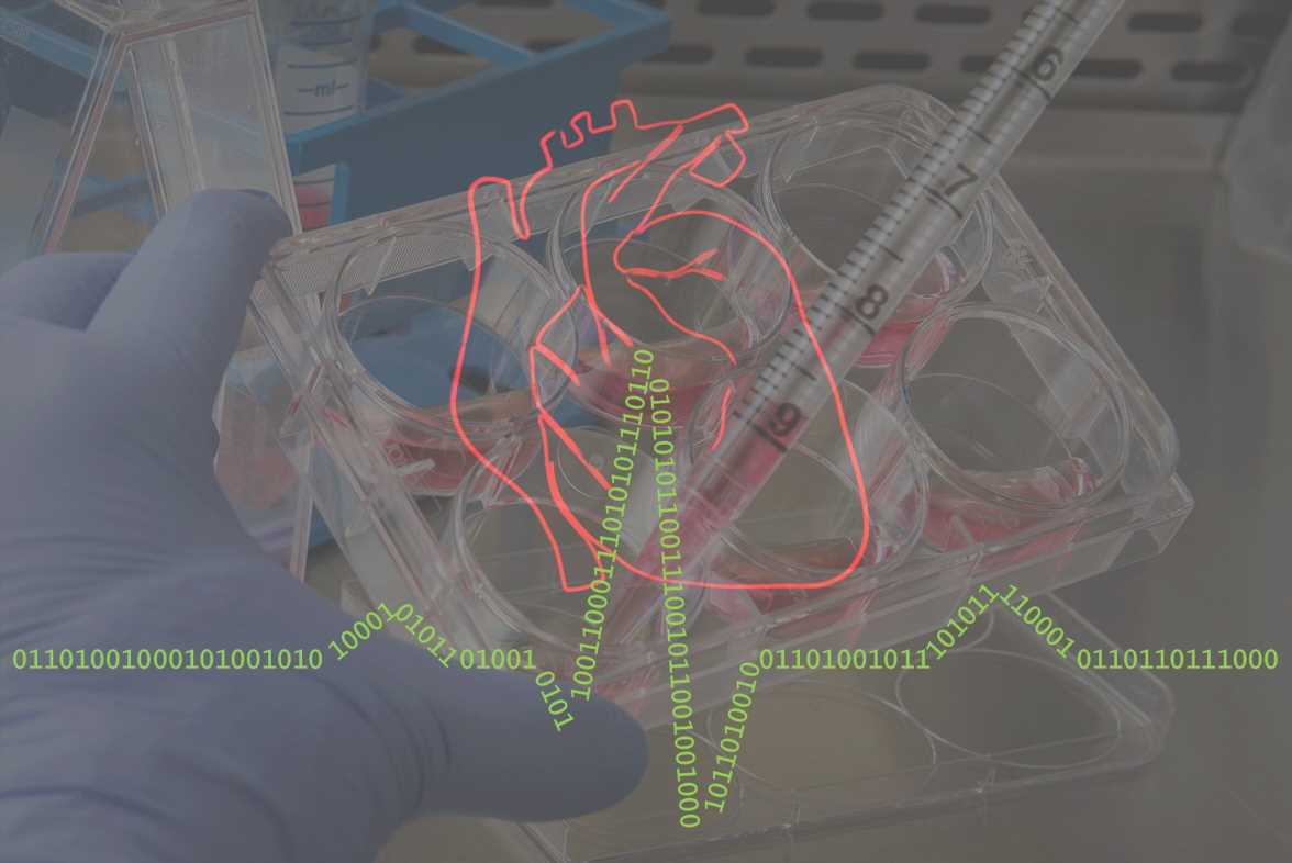 Stem cells and AI team up to predict cardiac arrhythmias in patients