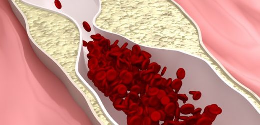 Study suggests a possible treatment approach for cancer and cardiovascular disease