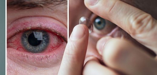 Wearing eye contacts for too long could lead to internal ‘damage’ and vision loss – signs