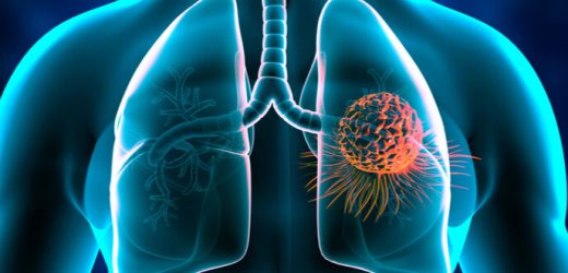 What happens when breast cancer spreads to the lungs?