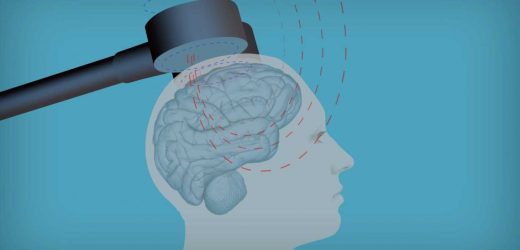 Why brain stimulation should not be overlooked as an antidepressant treatment for older adults