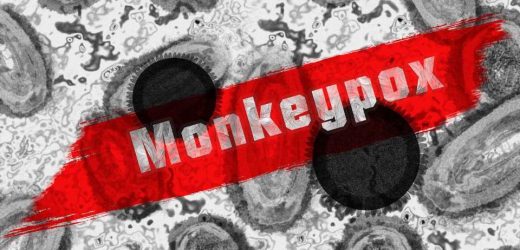 Are there monkeypox myths? A doctor breaks down disease fact and fiction
