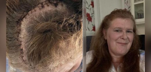 Asda worker mistook symptom for Covid stress before devastating diagnosis