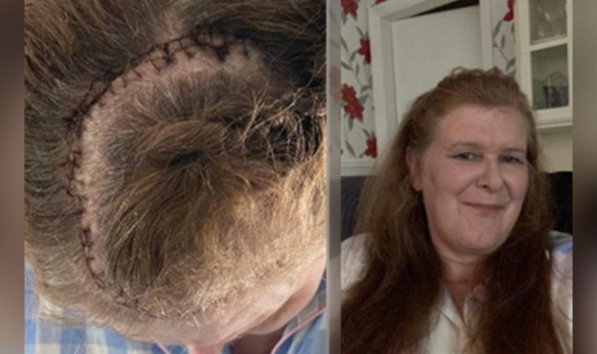 Asda worker mistook symptom for Covid stress before devastating diagnosis