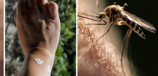 Mosquito bites: 4 signs you’ve been bitten and the best ‘natural anaesthetic’ for pain