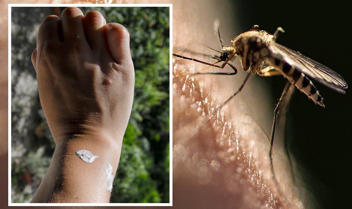 Mosquito bites: 4 signs you’ve been bitten and the best ‘natural anaesthetic’ for pain