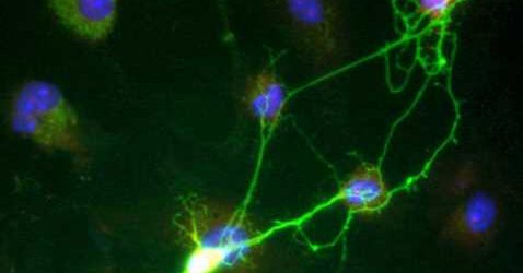 New role for blood-brain barrier in neuron function and damage
