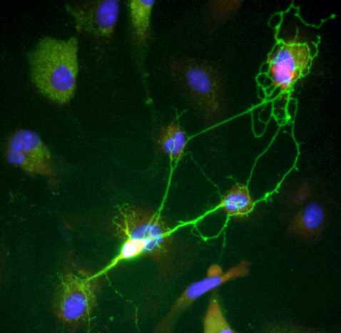 New role for blood-brain barrier in neuron function and damage