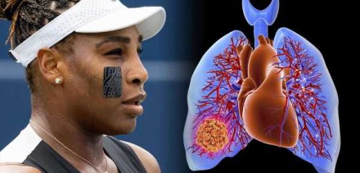 Serena Williams health: Blood clots ‘could have killed me’ – tennis pro tells all