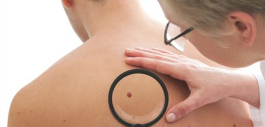 Antibiotics accelerate metastatic bone growth in mice with melanoma by depleting intestinal flora