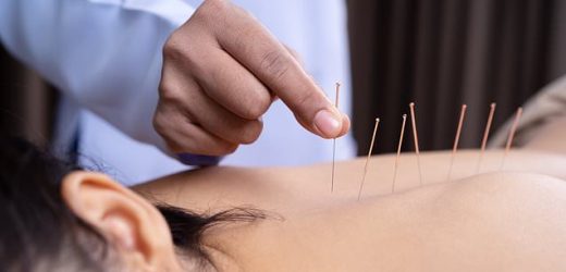 Flailing libido? Acupuncture could help, scientists say