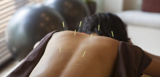 “I’ve just had the best period of my life – thanks to acupuncture”